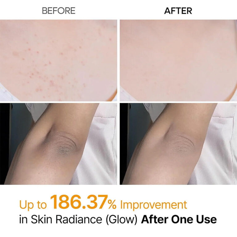 اسپری پیل شات کوجیک اسید و زردچوبه لایه بردار و روشن کننده بدن دکتر ملاکسین Dr.Melaxin Peel Shot Keratin Care Kojic Acid Turmeric Spray